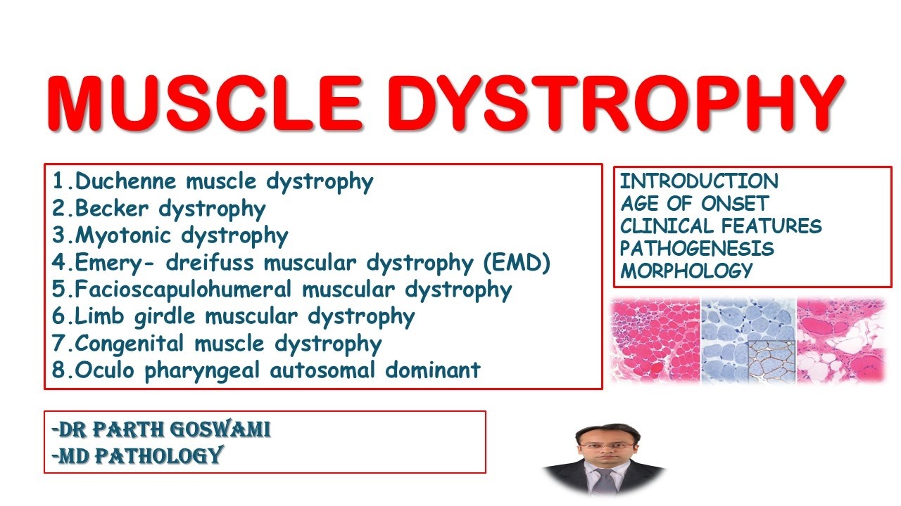 Muscle Dystrophy Pathology