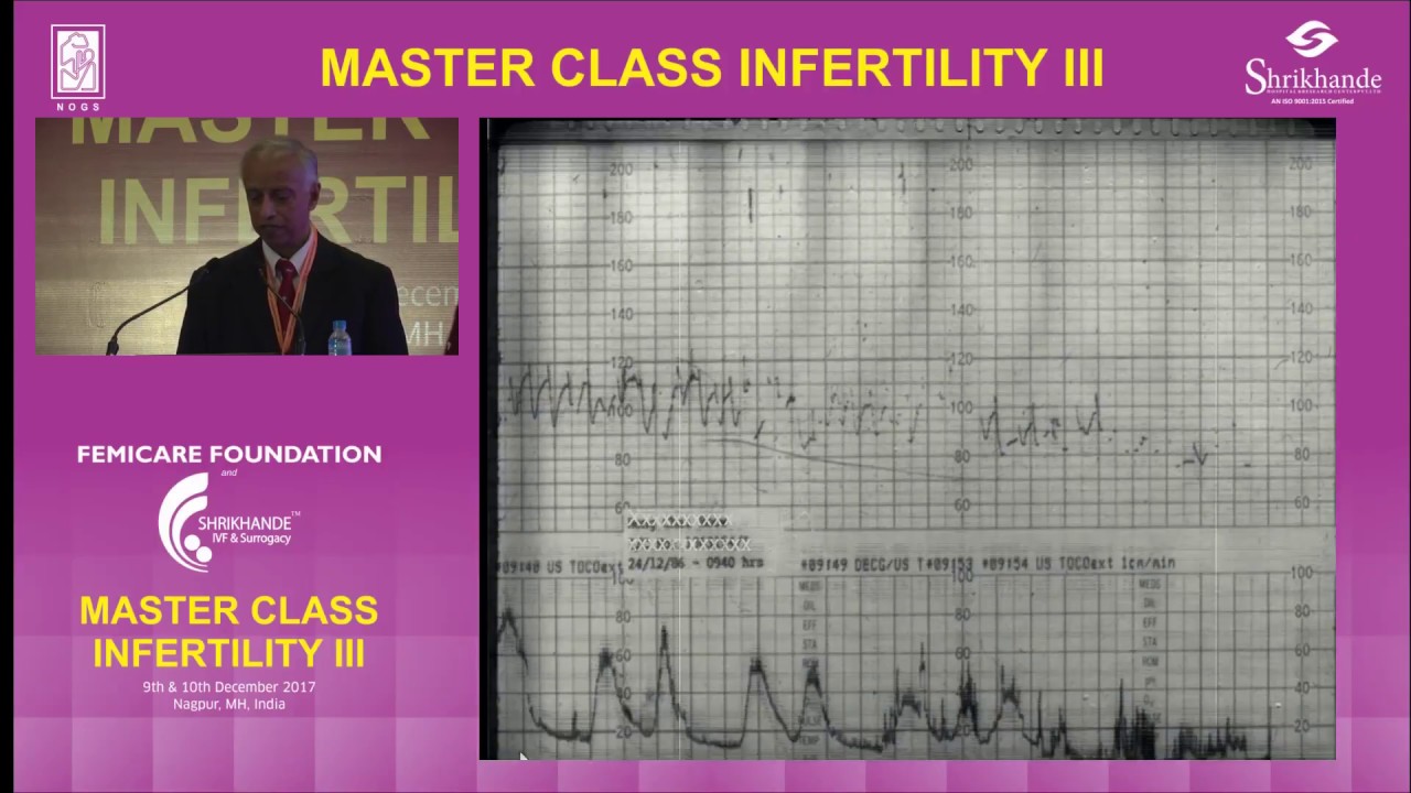 Difficulties with CTG Interpretation | Fertility Treatment | Prof  Arulkumaran Lecture Part 8