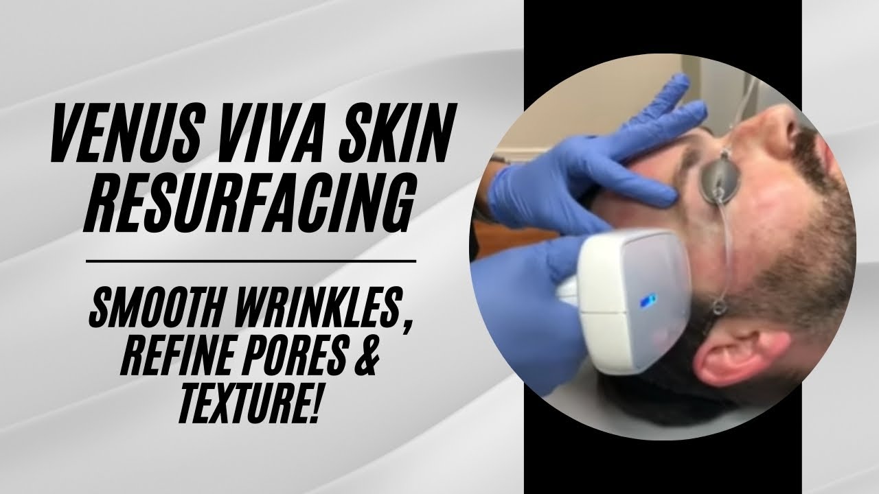 Skin Resurfacing Venus Viva Treatment for Wrinkles, Pores and Texture | Live