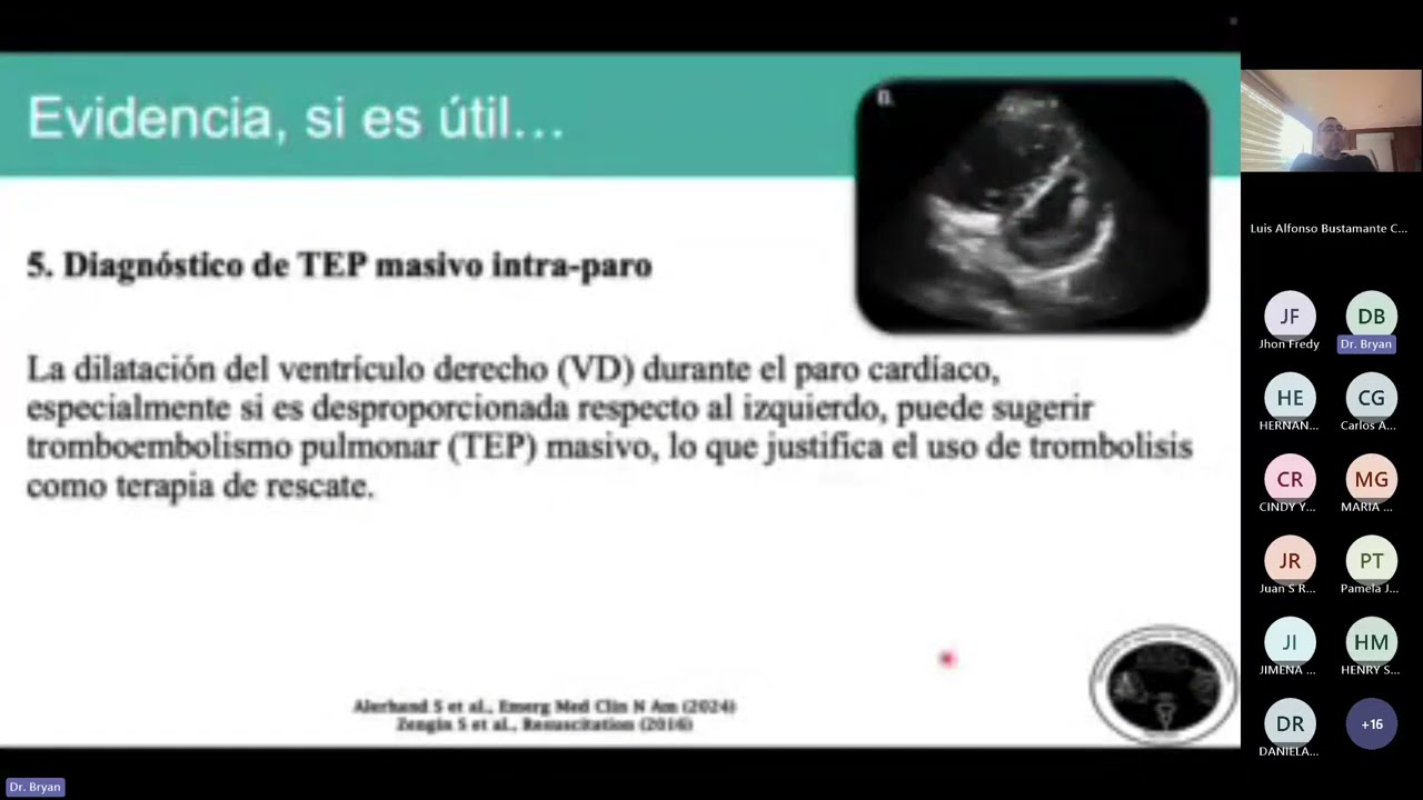 POCUS en parada cardiaca, RCP ¿ Debería utilizarse de rutina ?