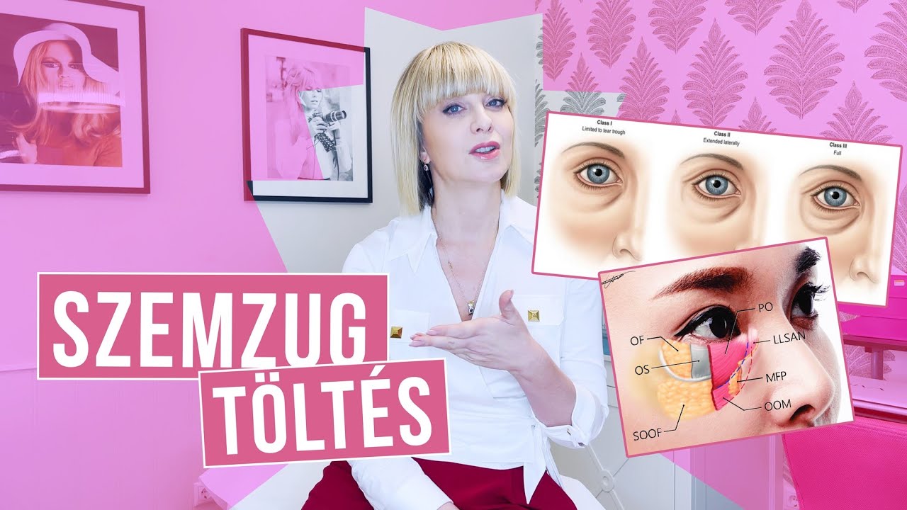 MINDENT A SZEMZUG TÖLTÉSRŐL DR. PÓNYAI KATINKÁTÓL
