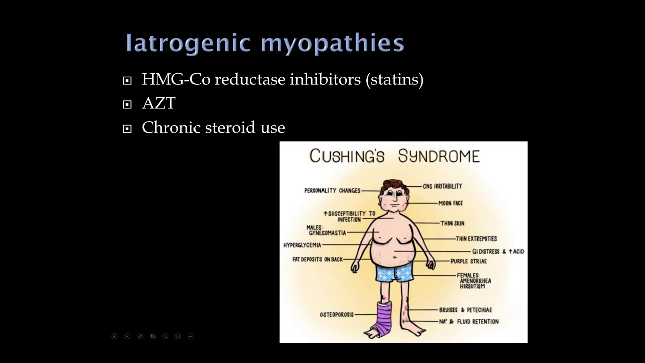 2. Quick Reviews: Muscle Disease
