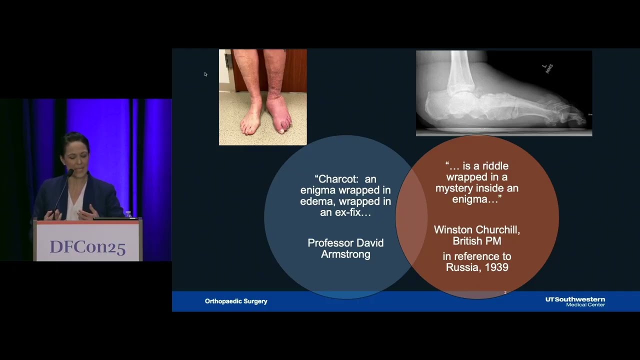 Charcot Neuroarthropathy: An Enigma Wrapped in Edema (DFCon on Demand - Sample Talk)