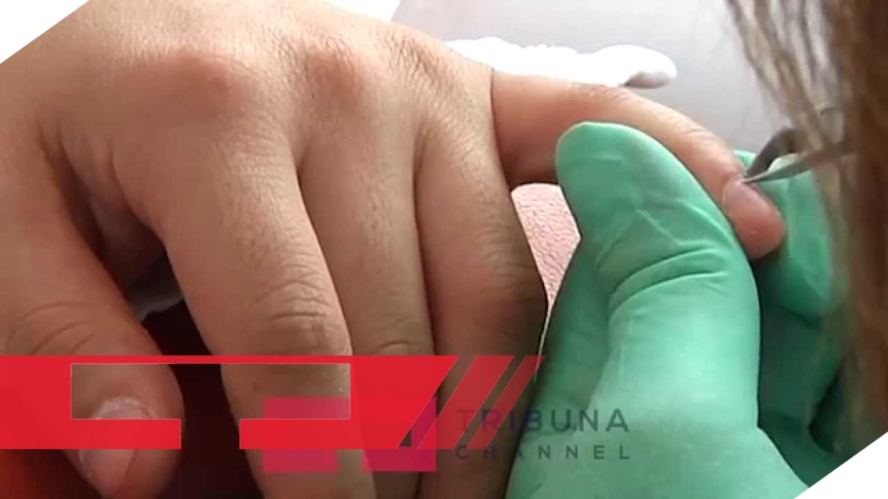 Njihuni me pregatitjen e mbjelljes së thonjëve