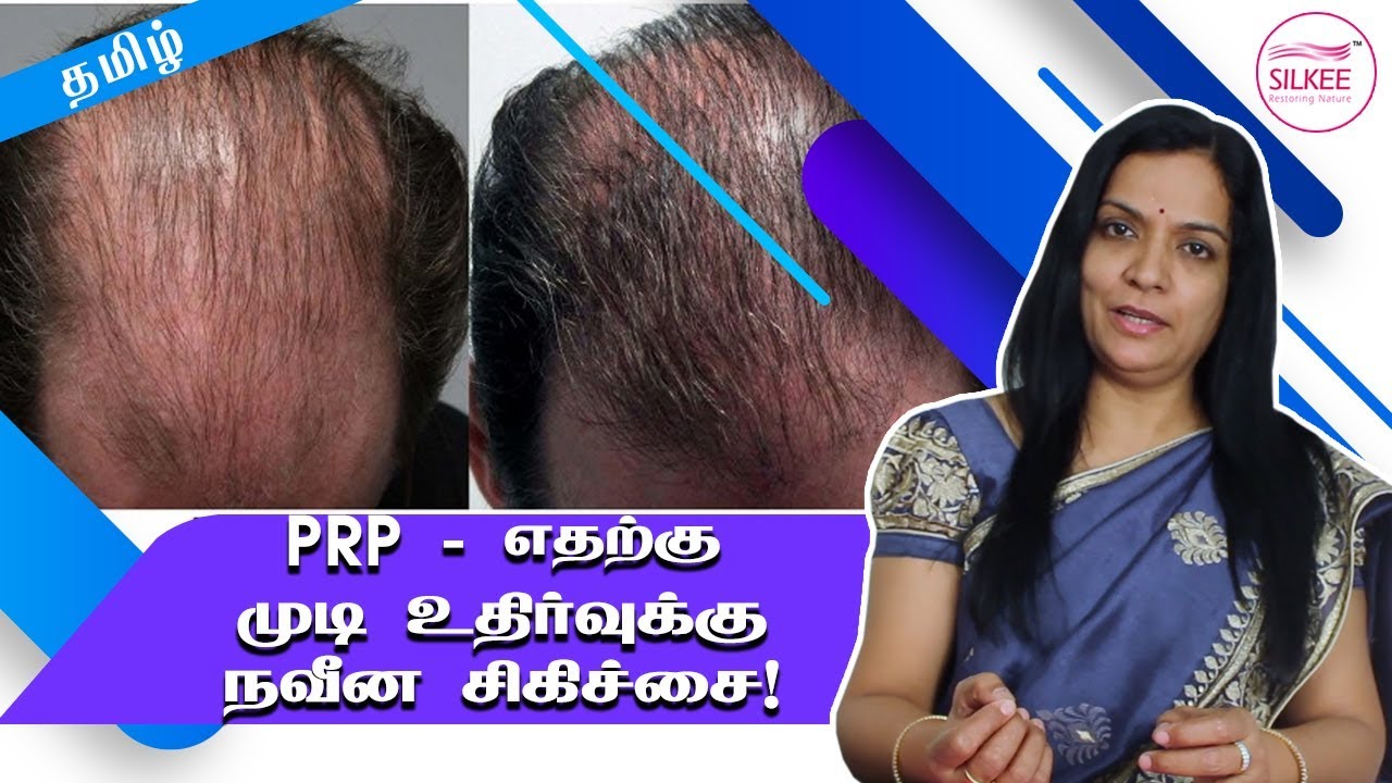 PRP எதற்காக? முடி உதிர்வுக்கு என்னதான் தீர்வு? | Hair transplantation | Root Therapy | Dr Sreelatha