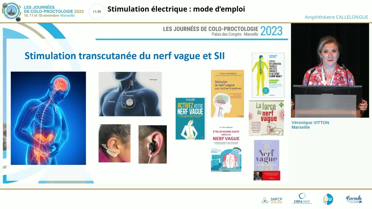 Stimulation électrique : mode d'emploi