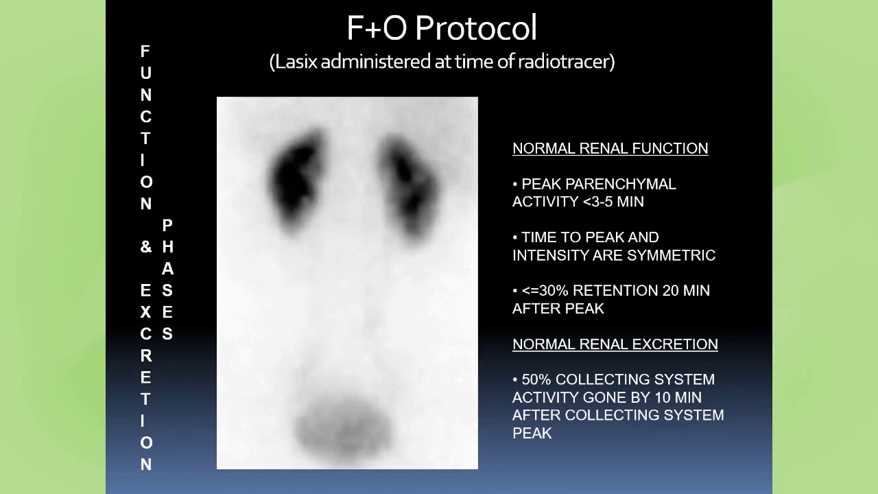 Diuretic Renal Scintigraphy in 2020: Where We Are (February 2020)
