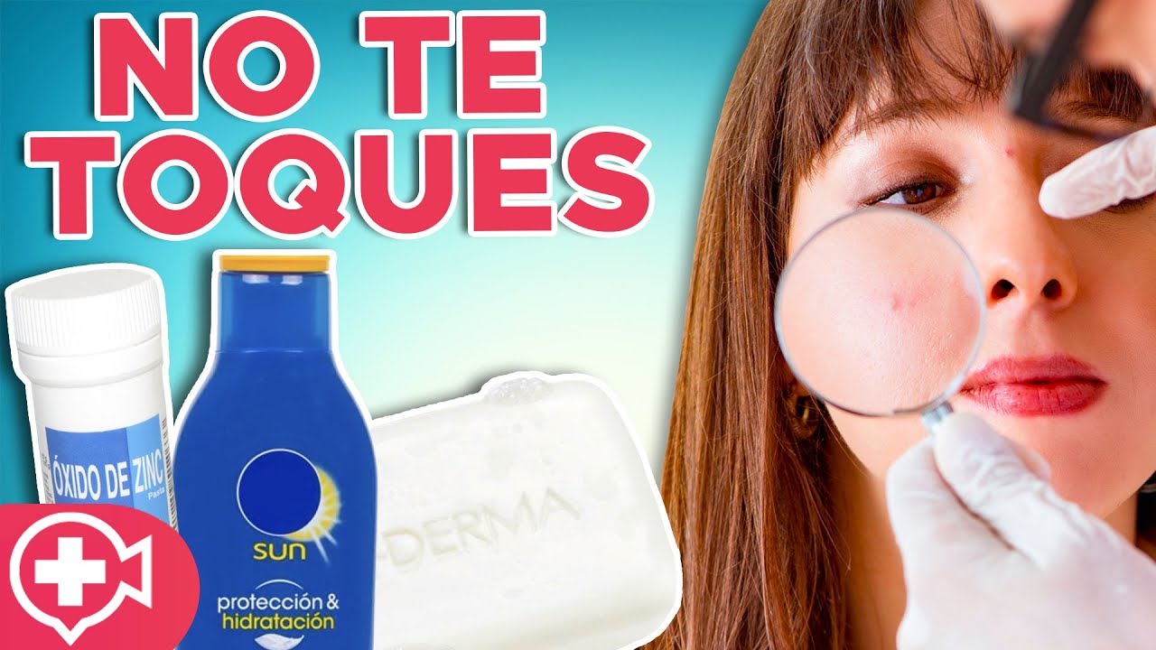 Manchas Rojas por Acné ¡ELIMINALAS para SIEMPRE!