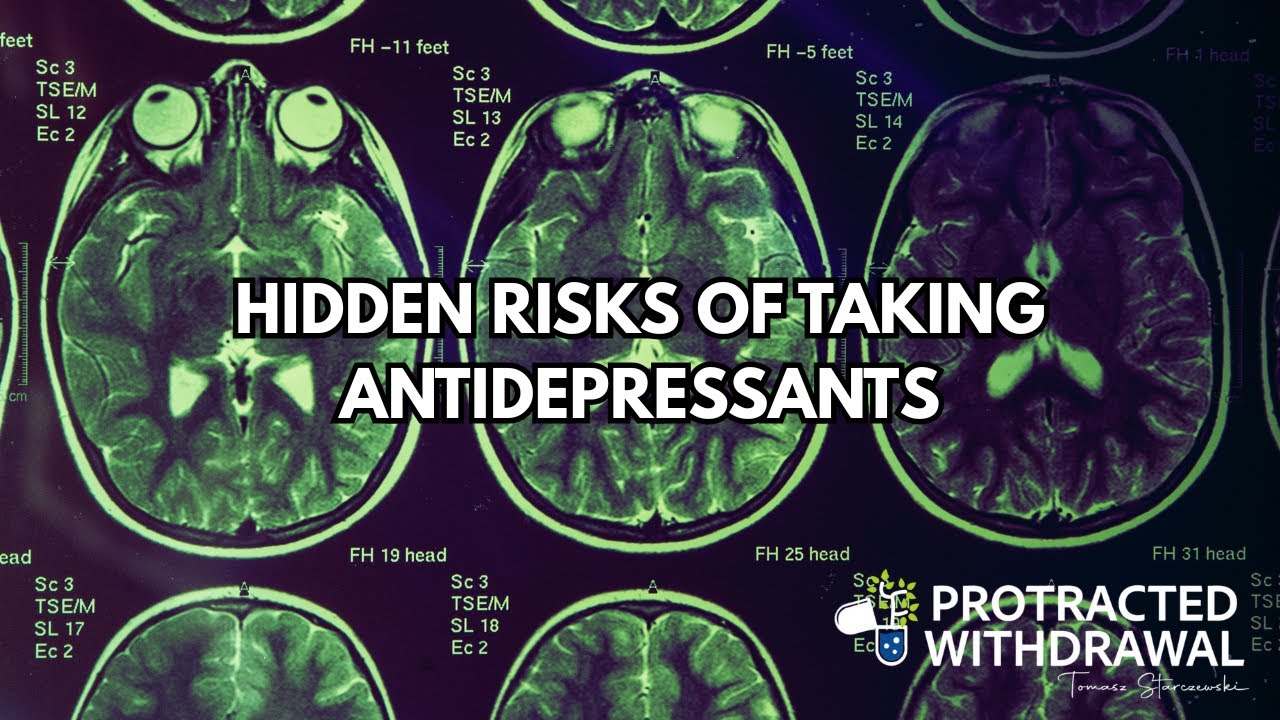 Antidepressants: Hidden Risks You Should Know About