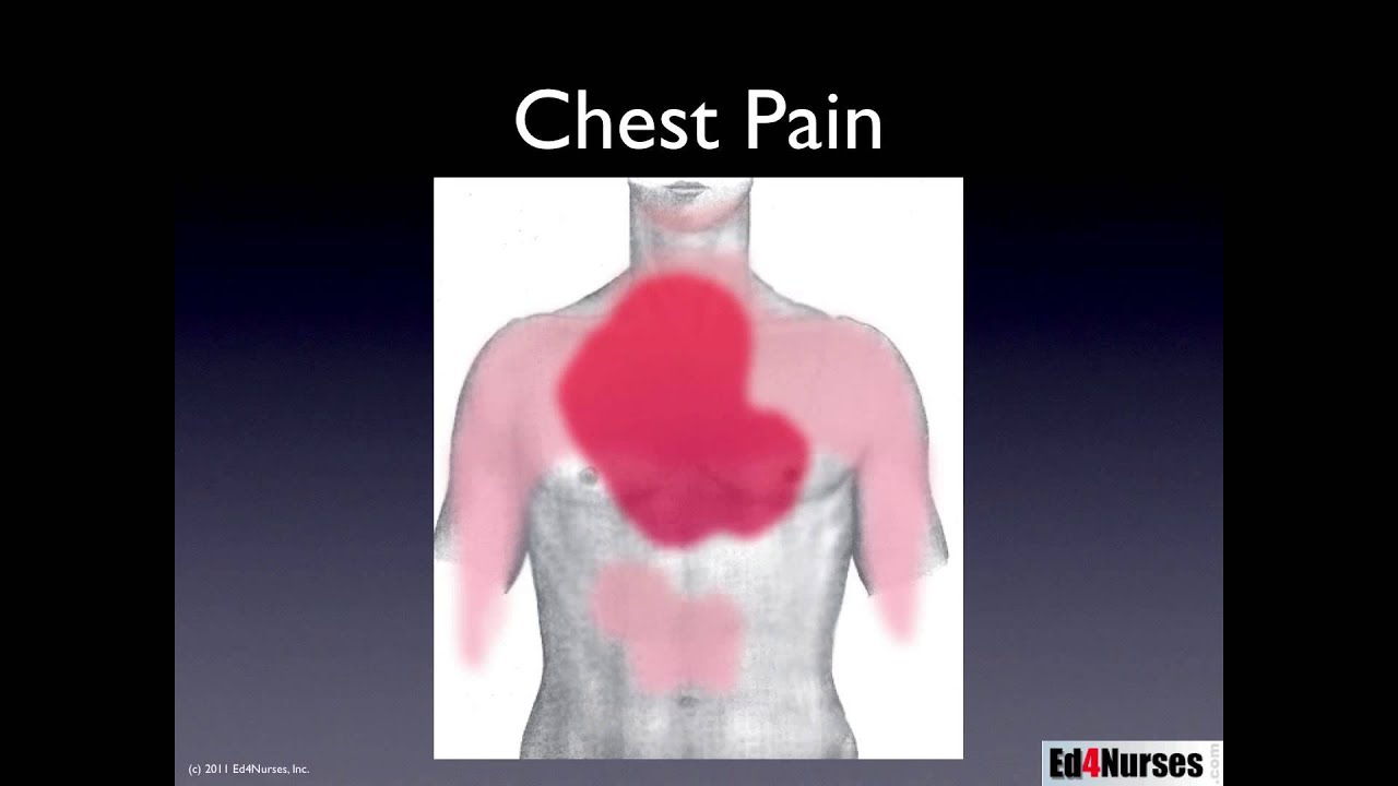 Complications of STEMI