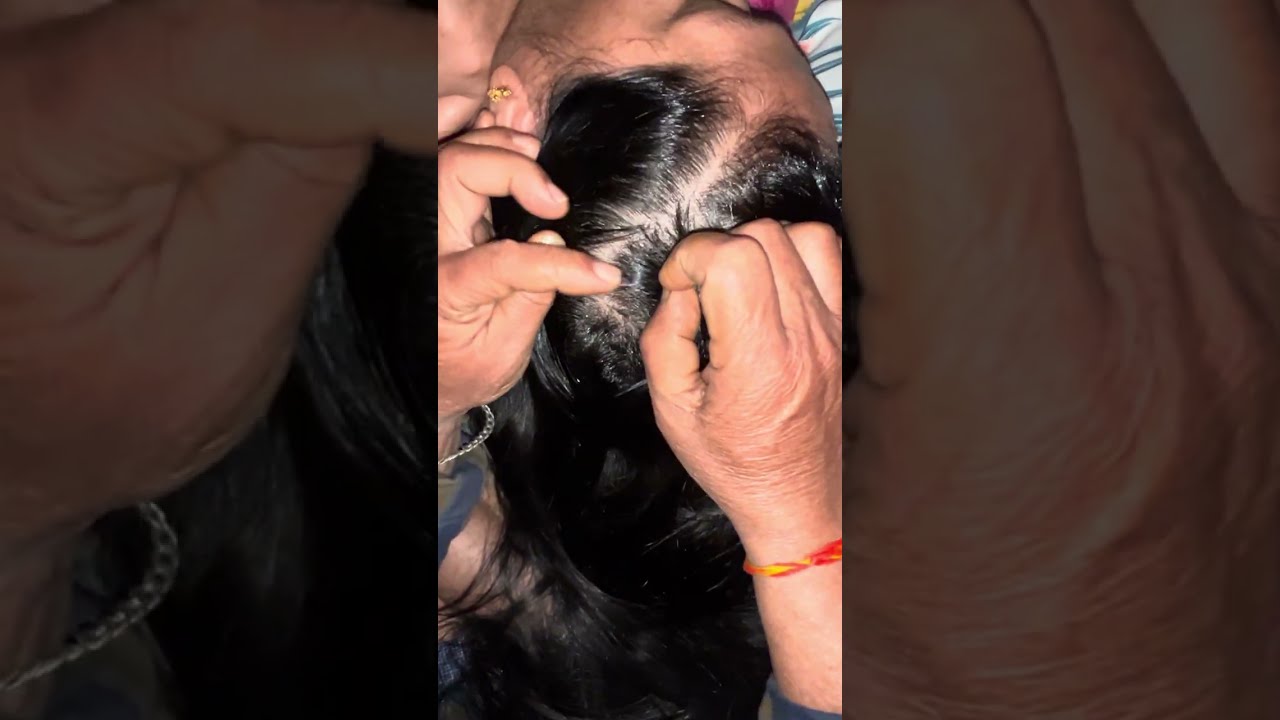 ✨💥Hair Scalping ASMR - Scratching, Nitpicking & Hair Care #asmrrelaxation #asmrhair #asmrforsleep 