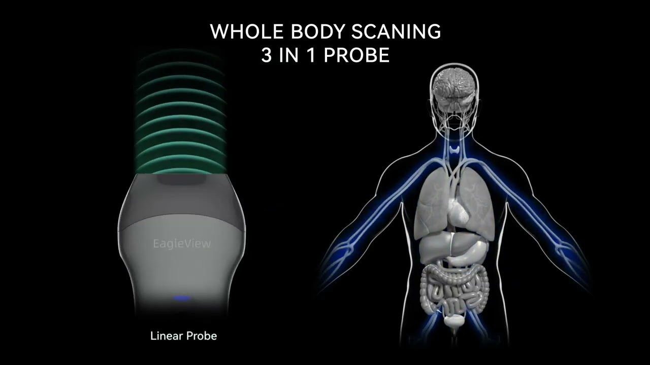 EagleView Wireless Ultrasound Scanner
