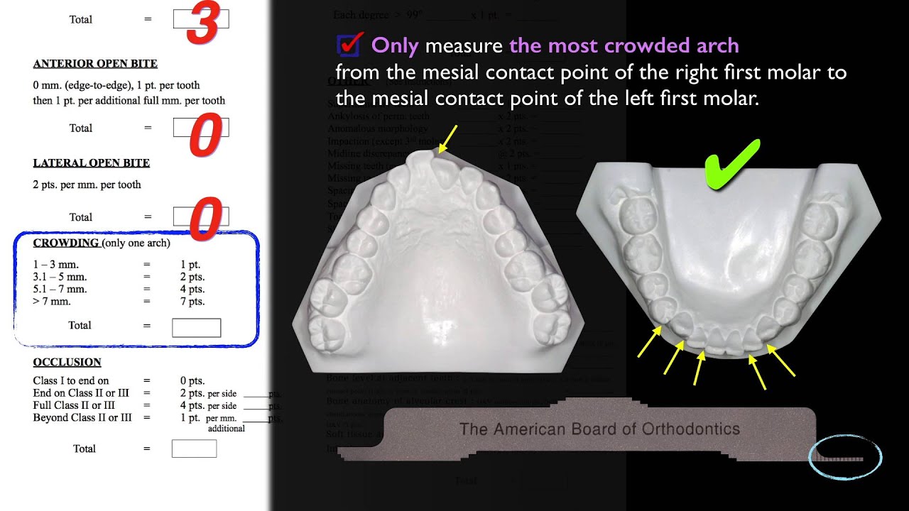 CC361. Discrepancy Index (DI) Part 3