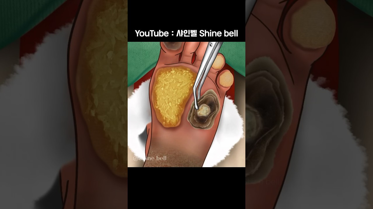ASMR Satisfying Foot Care Animation🎄#asmr #care #relax #satisfying