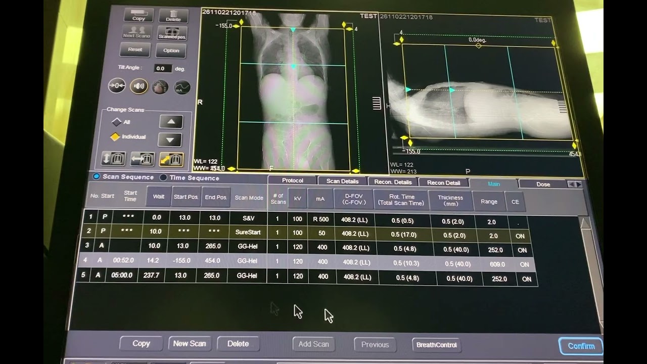 طريقه عمل اشعه مقطعيه ثلاثيه المراحل علي الصدر والبطن والحوض بالصبغه CT Traiphasic