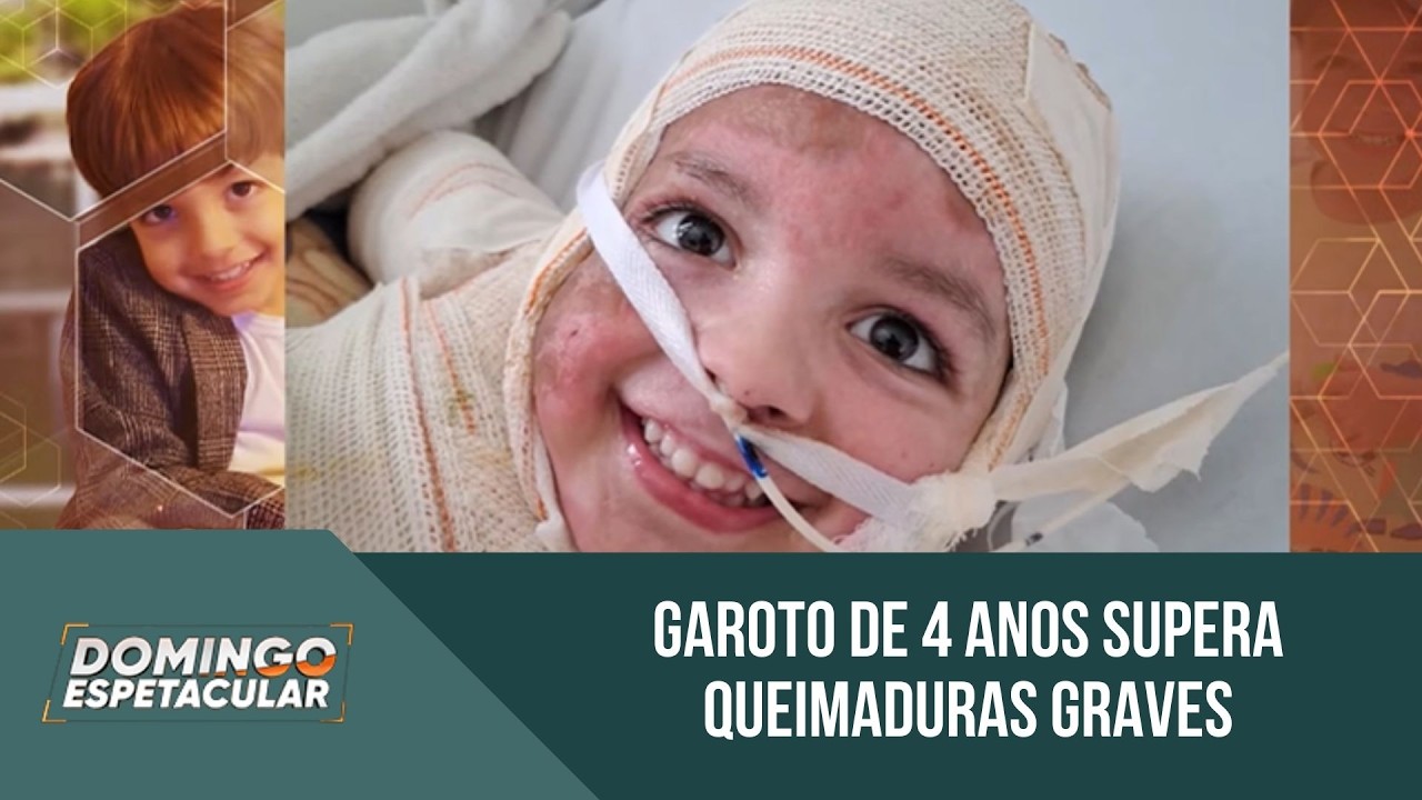Garoto de 4 anos supera queimaduras graves e é aplaudido ao voltar à escola | 'Domingo Espetacular'