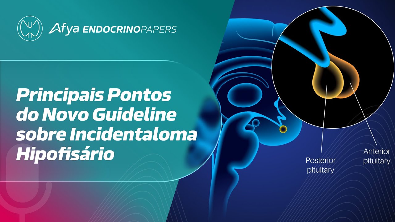Principais pontos do novo guideline sobre incidentaloma hipofis&aacute;rio