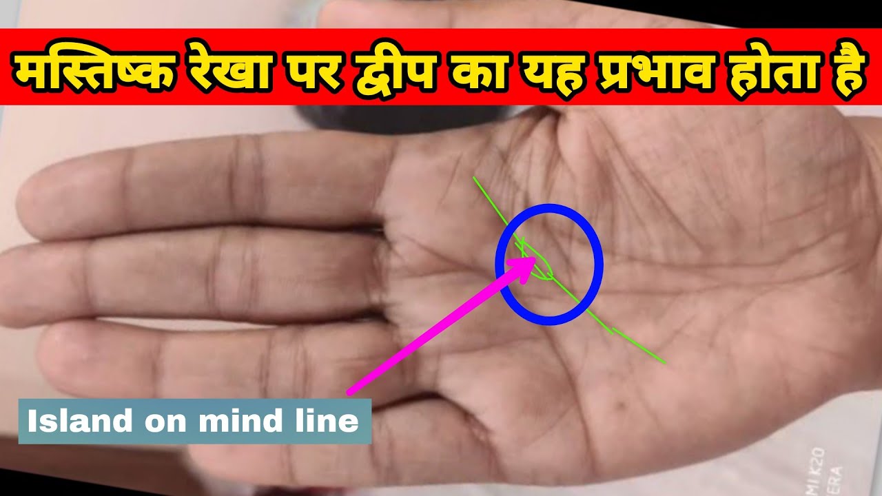 मस्तिष्क रेखा पर द्वीप का यह प्रभाव होता है। Island on mind line in palmistry