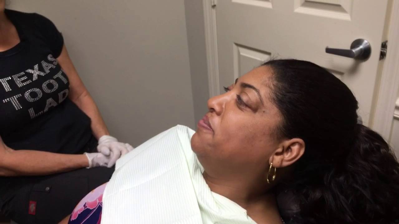 The TexasToothLady ..Houston Cosmetic Dentist discusses Lengthening teeth with Snap-on Smile...