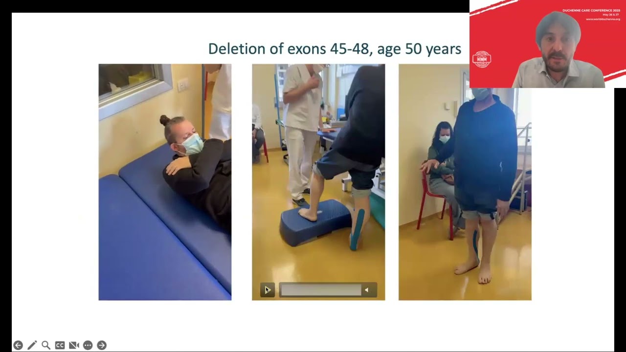 Prof. Bello - Management of Becker Muscular Dystrophy @ Duchenne Care Conference 2025