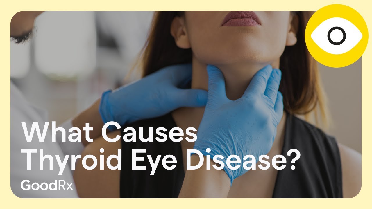 What Causes Thyroid Eye Disease, or Graves&rsquo; Orbitopathy? | GoodRx