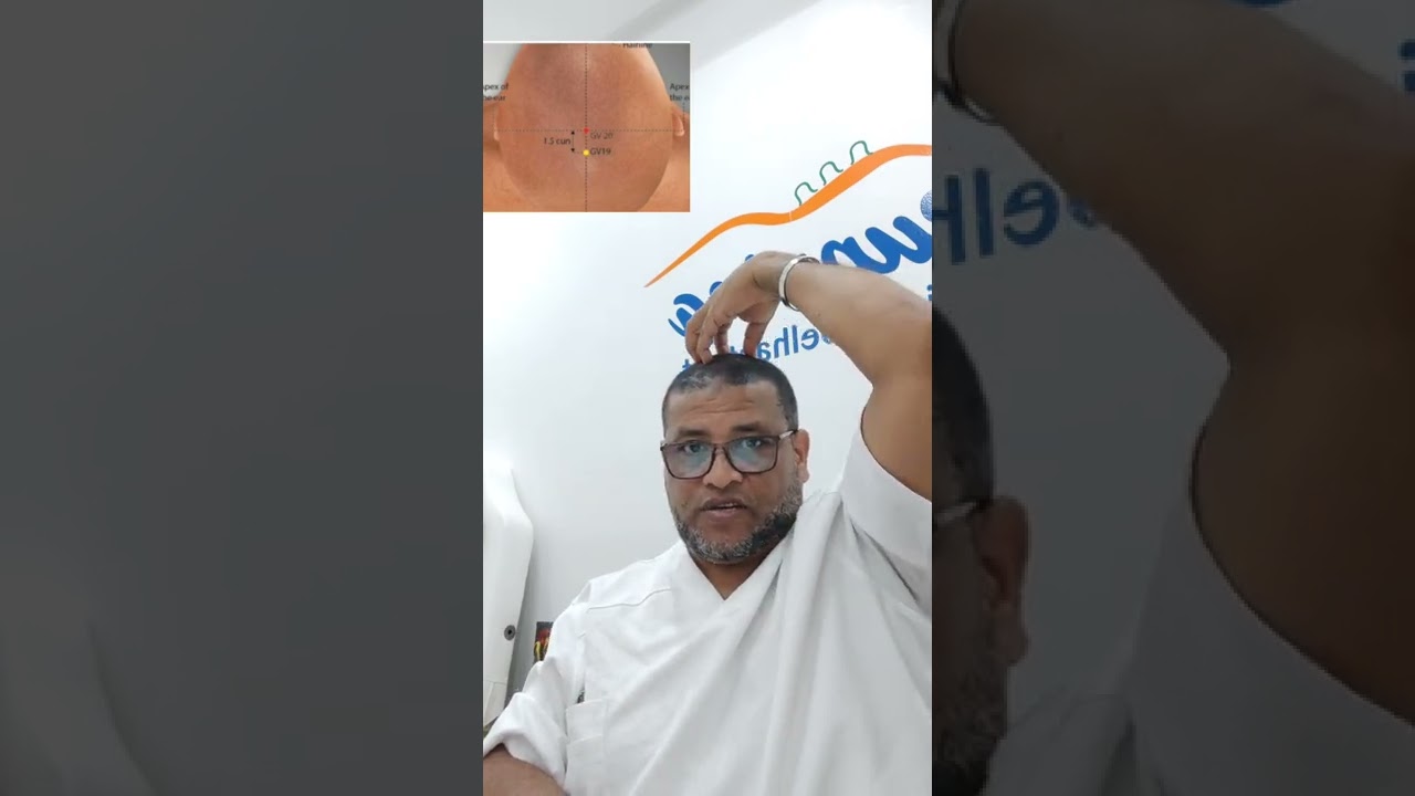 فوائذ نقطة DU20 حجامة المغيثة  المنقدة  وسط  الرأس ذ محمد بلهنتوت الحسيني 0668199203/0537605110تمارة