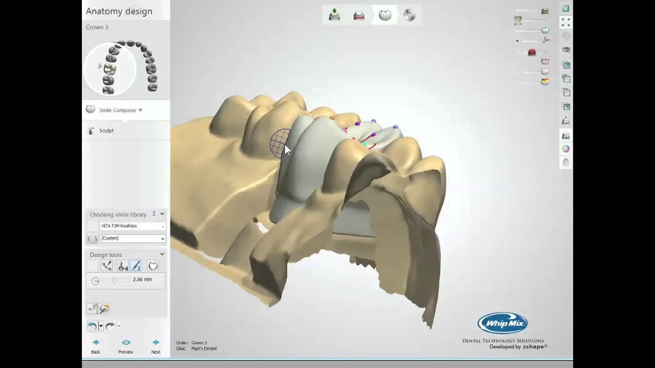 Intro to Dental CAD/CAM - Plan