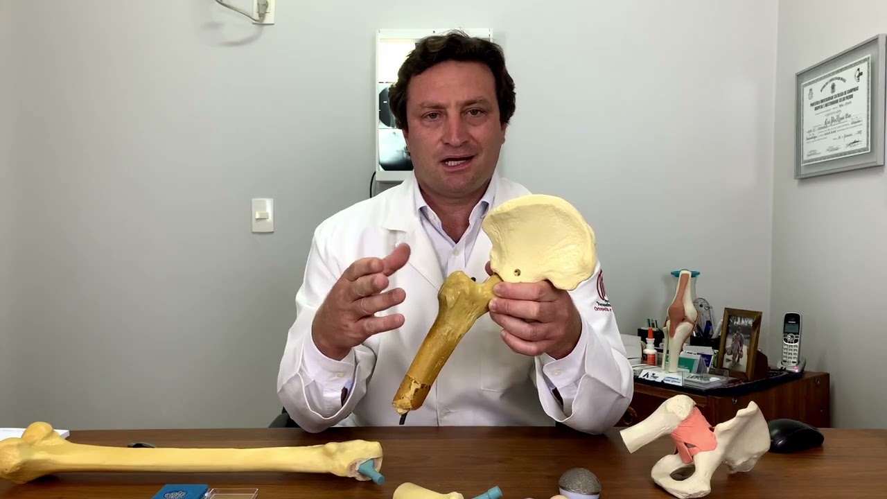 Entendendo a cirurgia no quadril feita pelo ex- jogador Zico | Saúde em Dia
