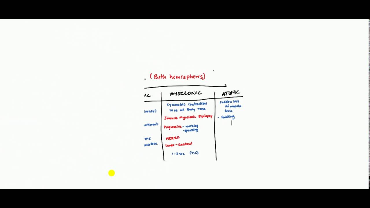 Seizure and Epilepsy for USMLE Step 1 and USMLE Step 2