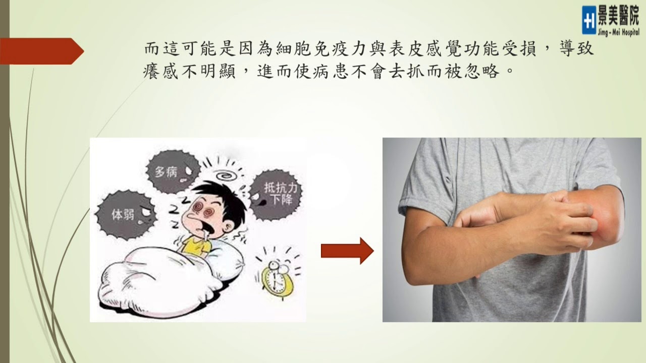 景美醫院(皮膚科)-疥瘡(疥蟲叮咬）