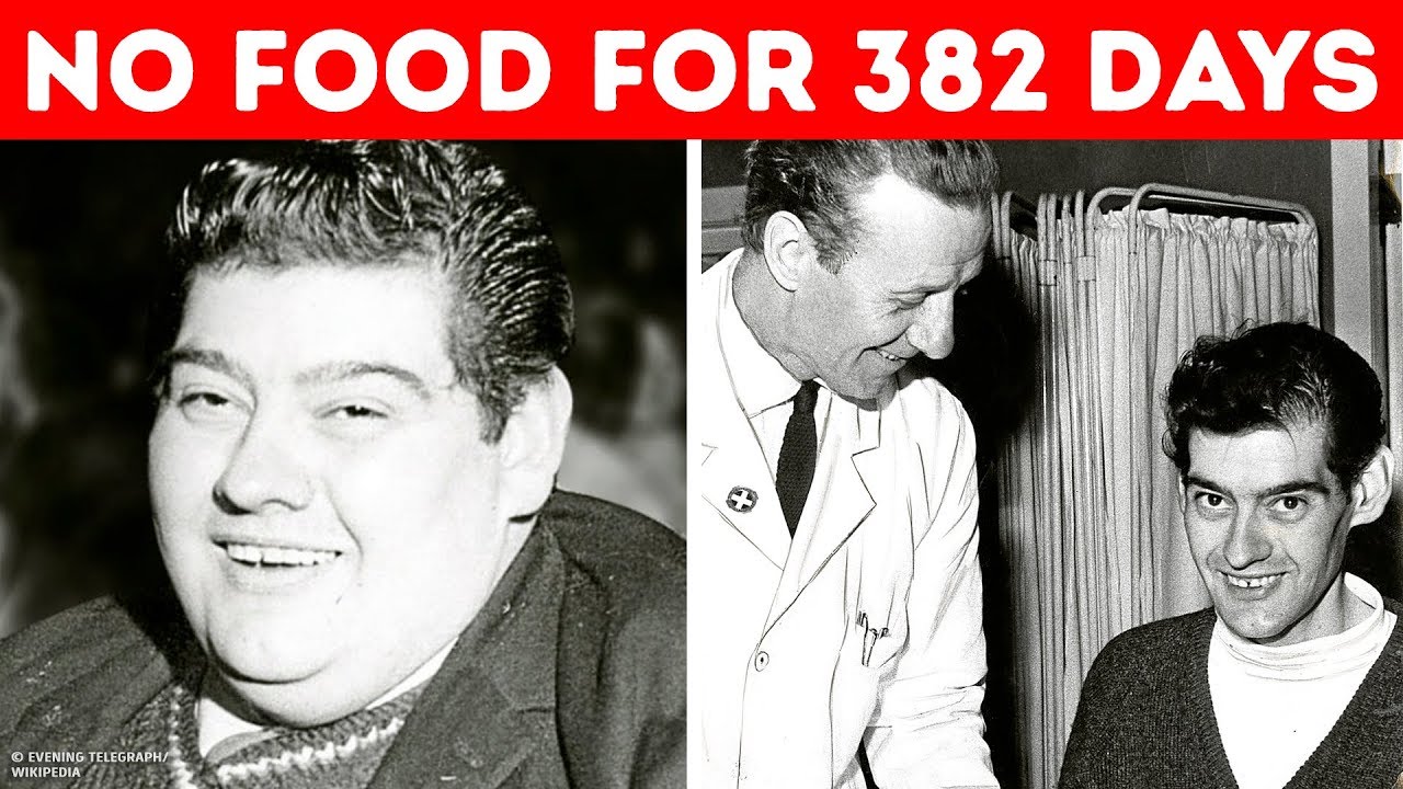 The Man Who Went 382 Days Without Food — A True Story