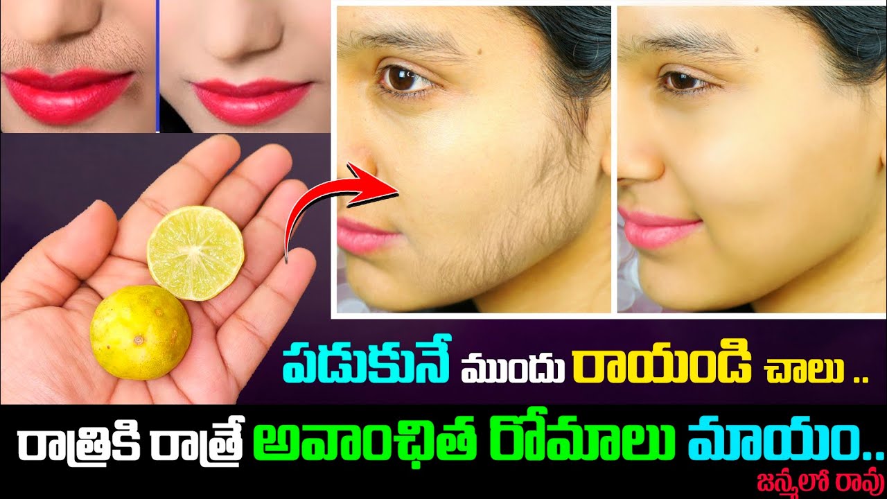 పడుకునే ముందు రాయండి చాలు..రాత్రికి రాత్రే అవాంఛిత రోమాలు మాయం || Unwanted Hair Removal Remedy