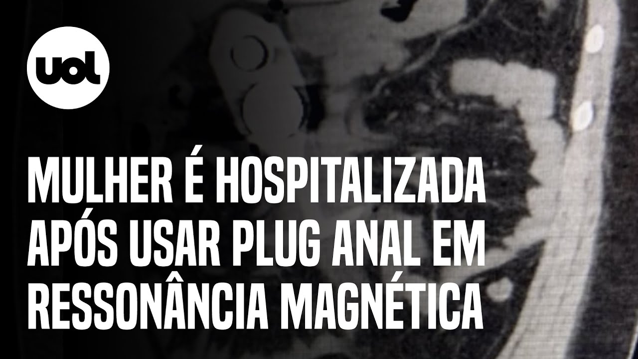 Plug anal durante resson&acirc;ncia magn&eacute;tica causa acidente nos EUA; paciente foi hospitalizada