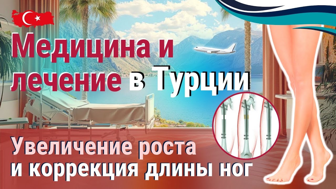 Увеличение роста и коррекция ног в Турции: Медицина, меняющая жизнь!