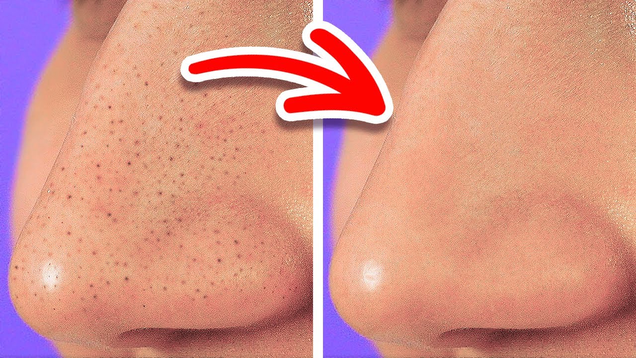 33 IDEIAS NATURAIS PARA TER UMA PELE LINDA