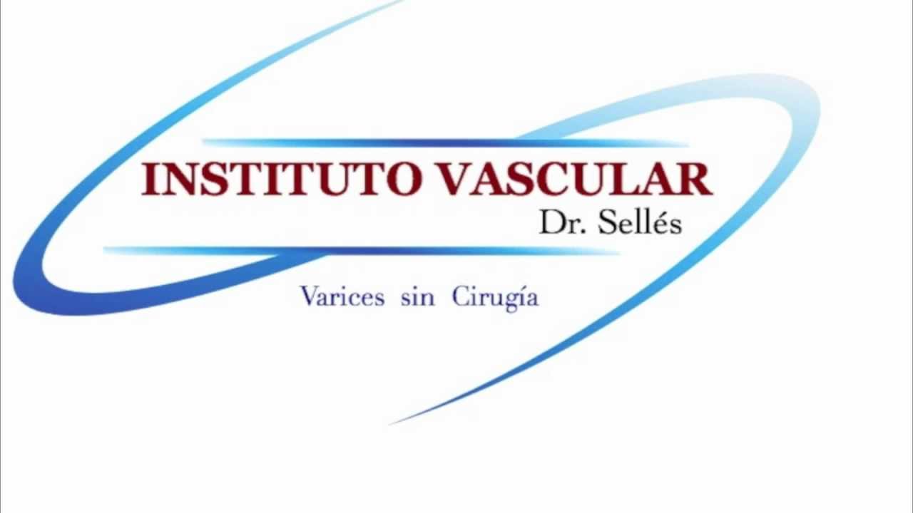Varices sin cirugia con microespuma