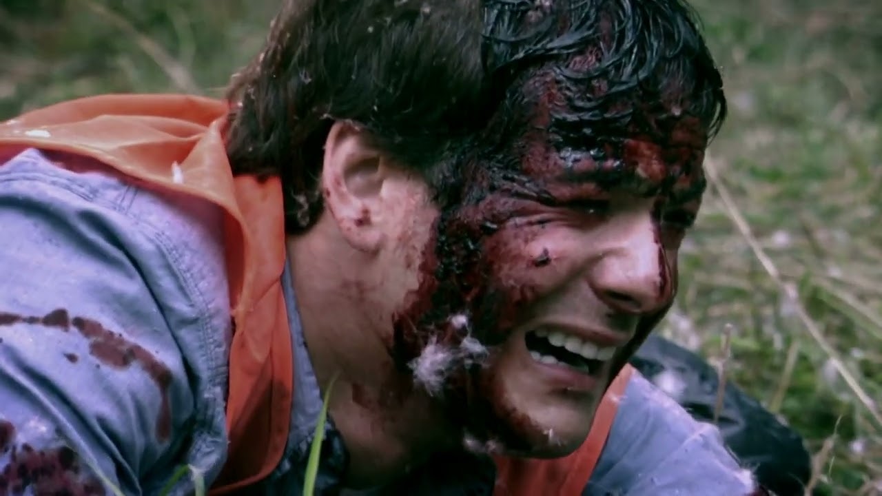 Teen Survives Brutal Grizzly Bear Attack Montana