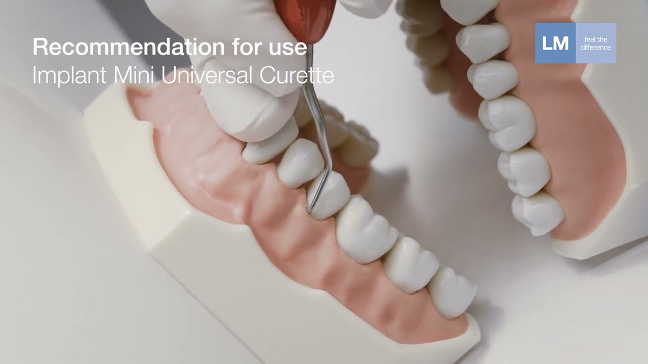 How to use LM-ErgoMix™ hand instruments with titanium implant tips