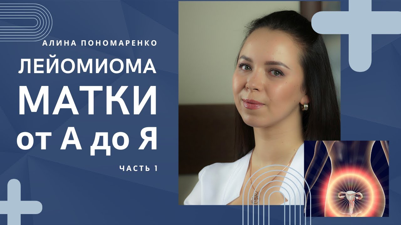 Лейомиома (фибромиома) матки от А до Я.   Гинеколог-эндокринолог Алина Пономаренко. Днепр. Украина.