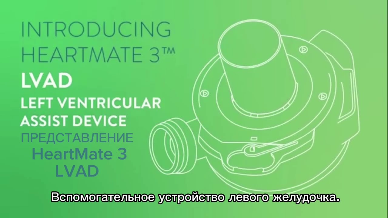 Что такое LVAD - вспомогательное устройство левого желудочка сердца?