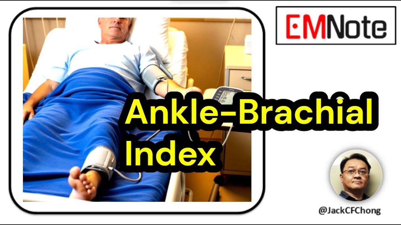 ABI：Ankle-Brachial Index
