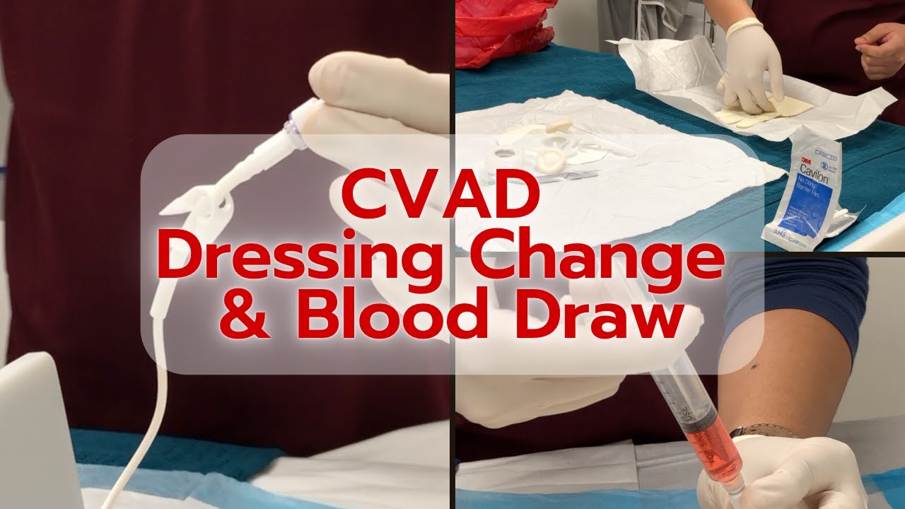 Central Venous Access Device (CVAD) Dressing Change & Blood Draw Demonstration