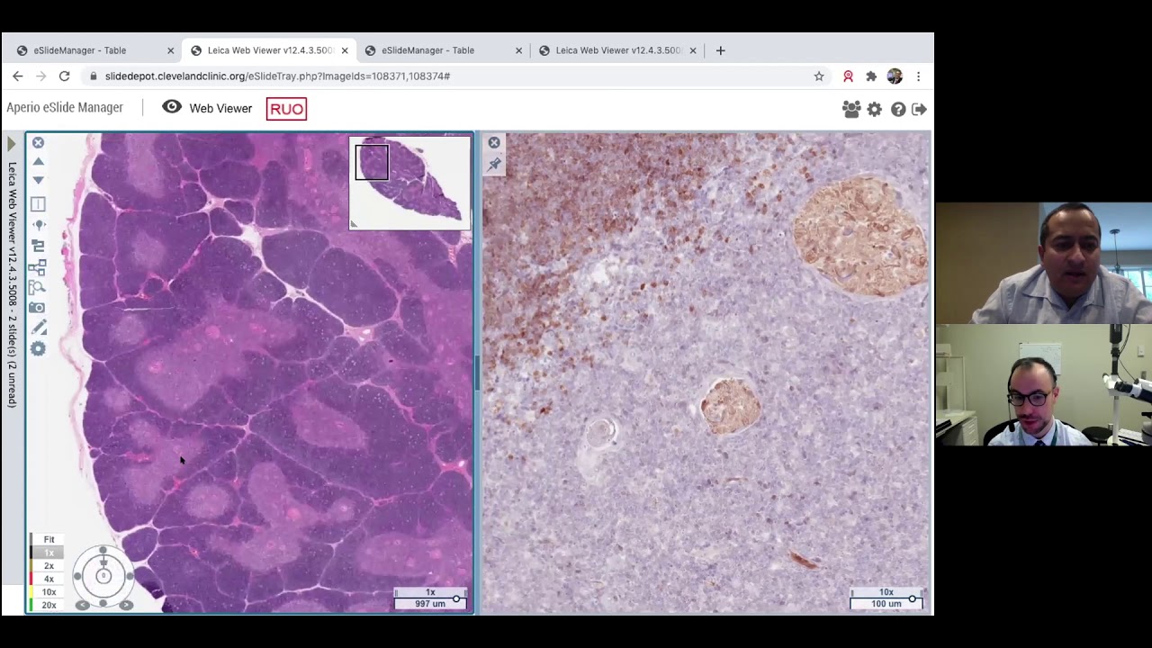 Fresh Air With the Lung Path Guys. Episode 1: Normal Thymus