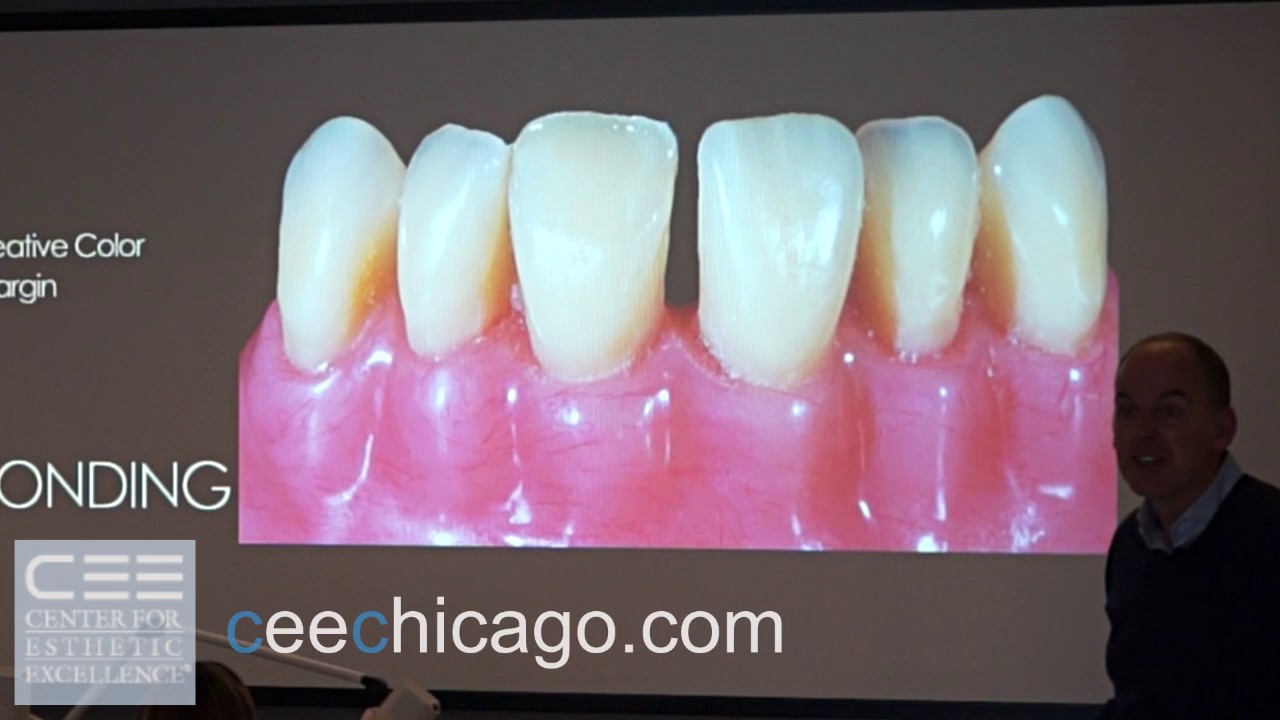Class IV - The Simplified Approach - Dr. Jason Smithson