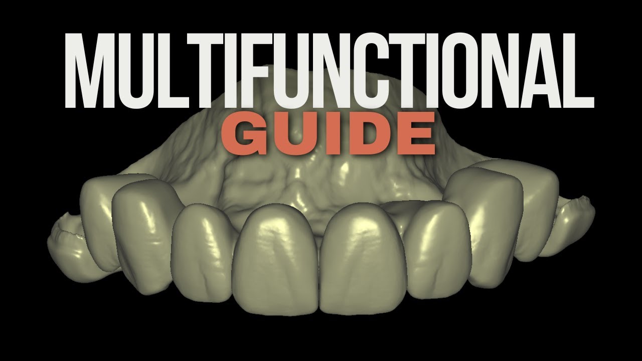 Partial Arch FP1 Prosthesis and Smile Design in EXOCAD