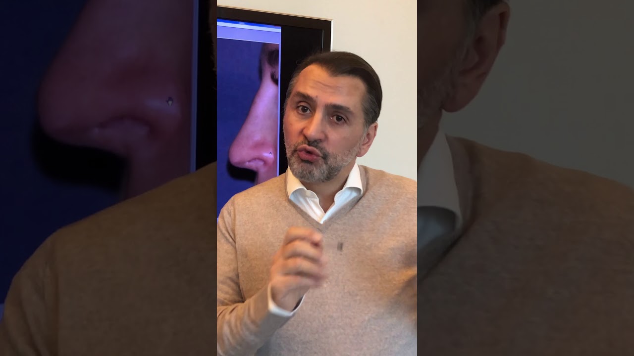 BOSSE RESIDUELLE APRES RHINOPLASTIE : Quelle solution ?