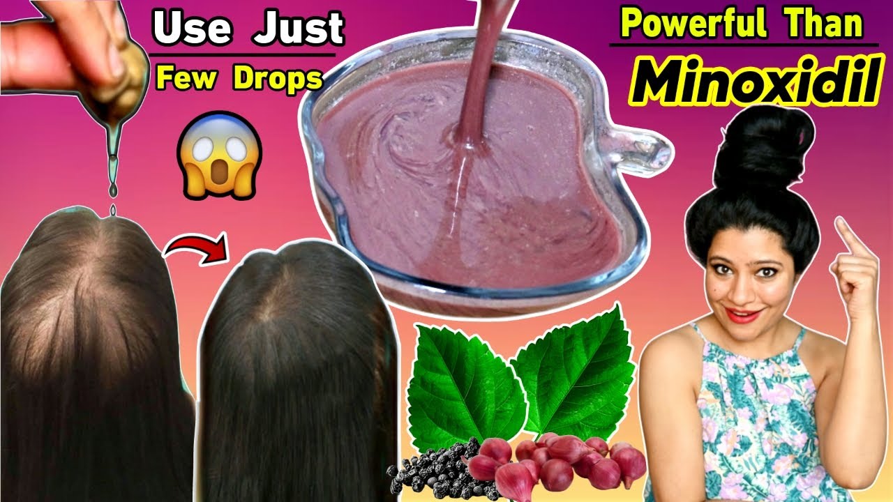 I Had Bald Patch On My Scalp I Used Only Few Drop Of This Gel To Regrow Hair (Natural Minoxidil)