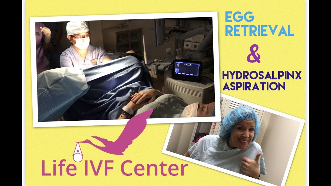 Egg retrieval and hydrosalpinx aspiration