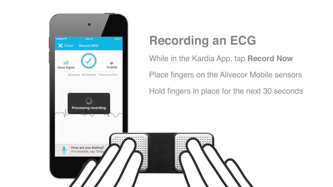 AliveCor Mobile ECG | Training for NHS Clinicians