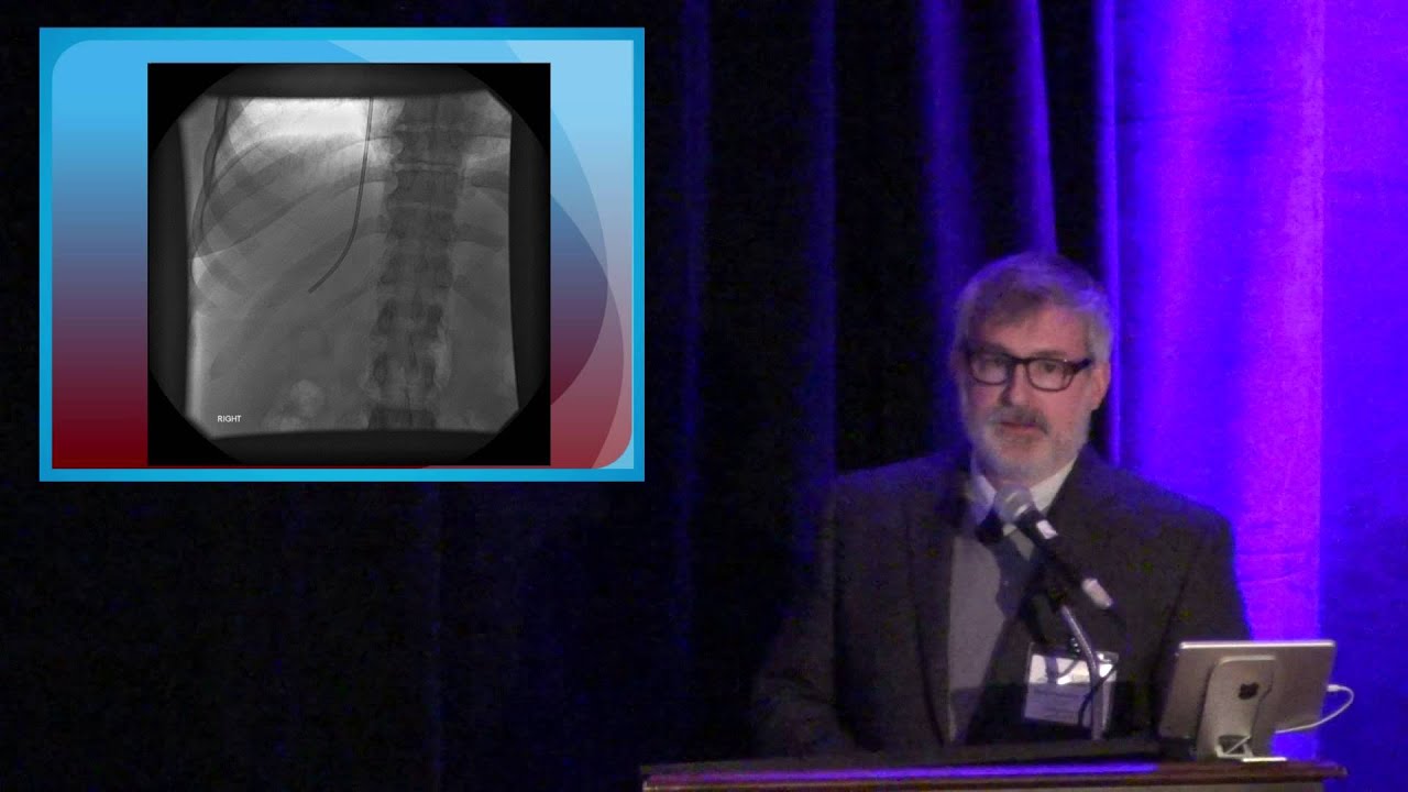 Portal Hypertension Panel, Part 2: Transjugular Liver Biopsy